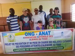 Article : Campagne de sensibilisation à Sotouboua: ANAT contre  l’albinisme au Togo